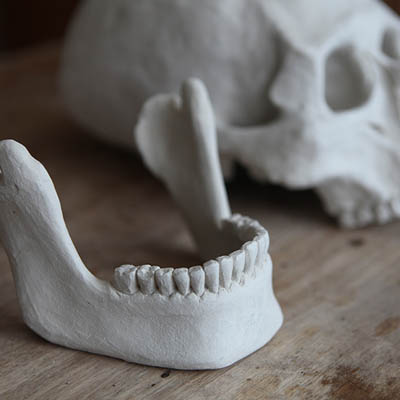 <b>The Peruvian Skull Jaw</b><br>The jaw from the Peruvian Skull.